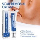 scar-cream-scar-removal-cream-silicone-s-3.jpg