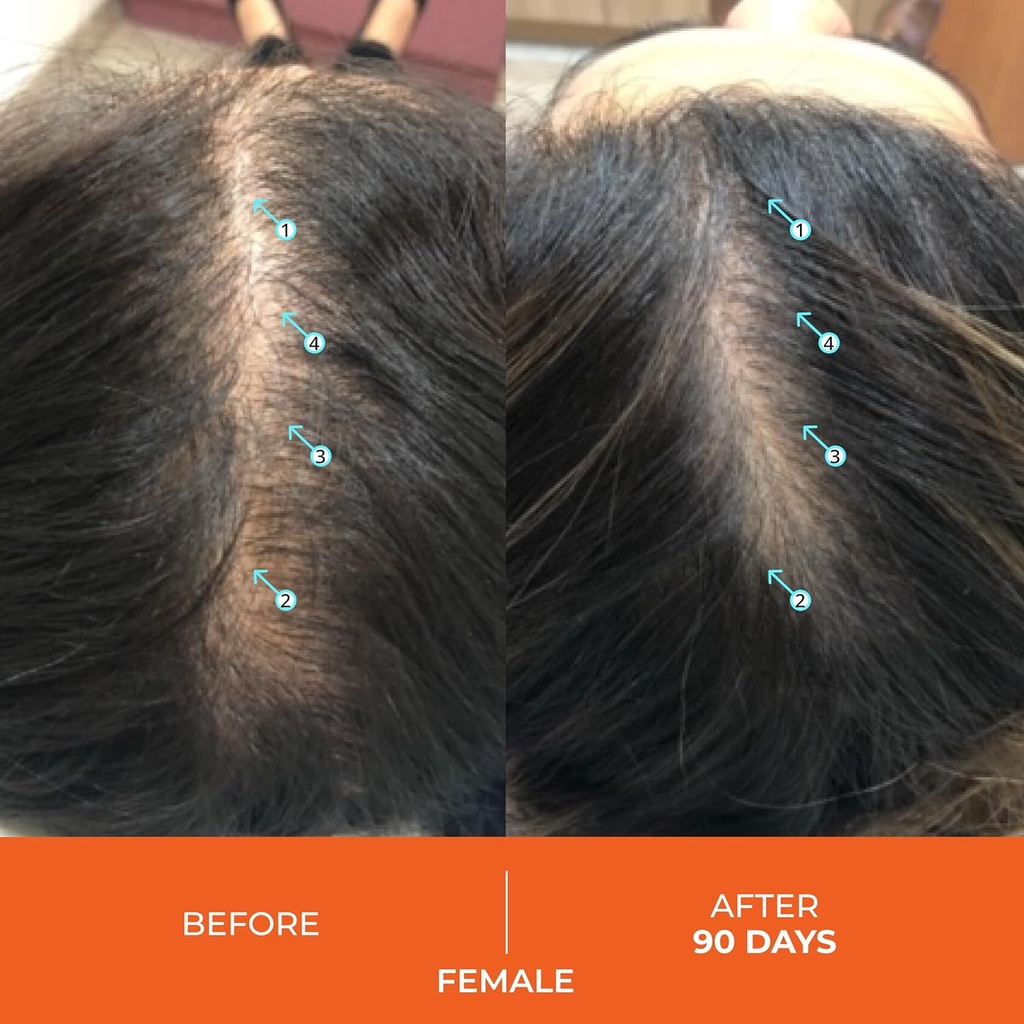 ds-labs-revita-hair-vitamin-gummies---su-5.jpg