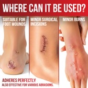 fresinider-silicone-foam-dressing-with-a-71uAB3jIzcL.jpg