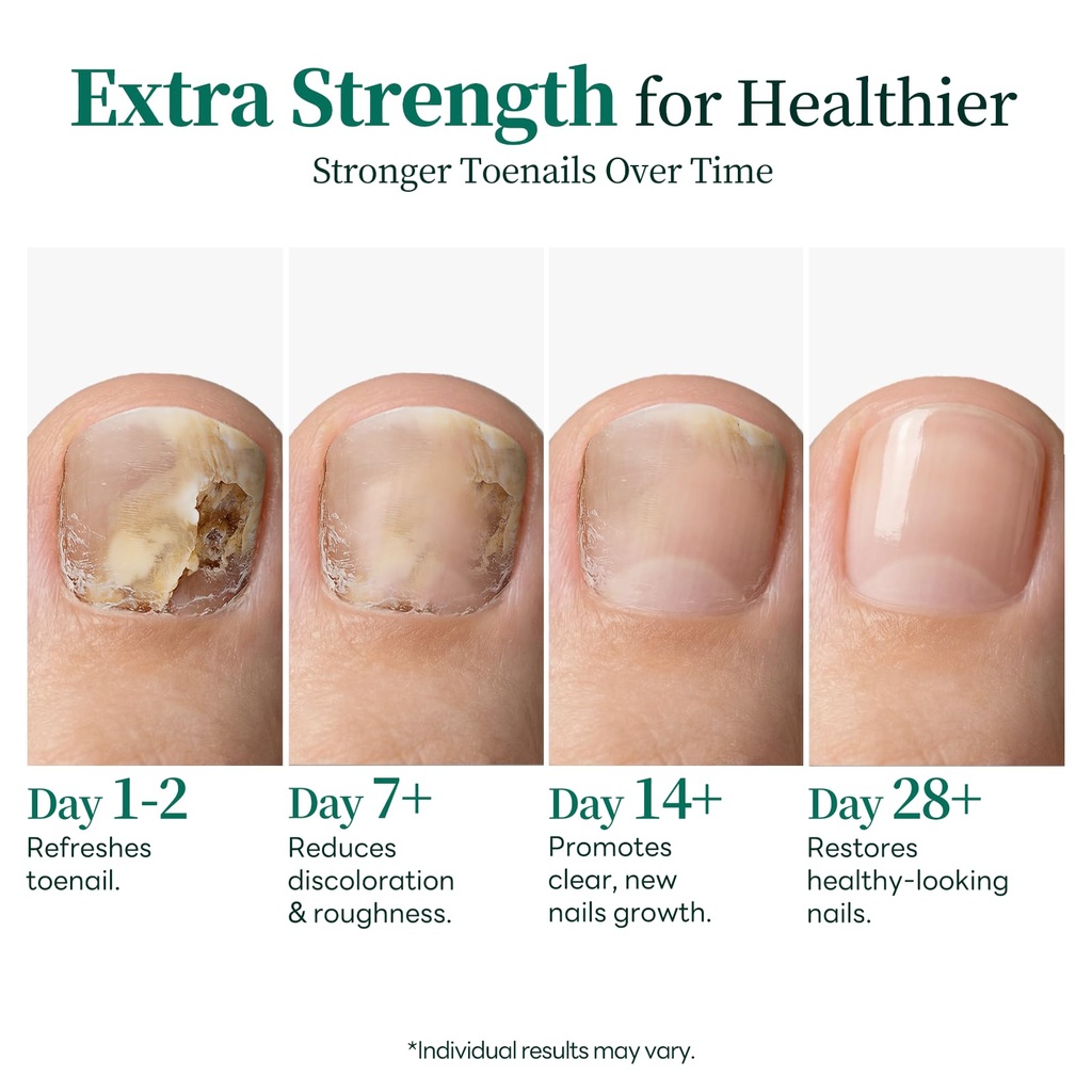 apuree-day-night-fungal-pen-extra-streng-7125cMHePIL.jpg