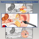 ear-wax-removal---electric-ear-cleaner---4.jpg