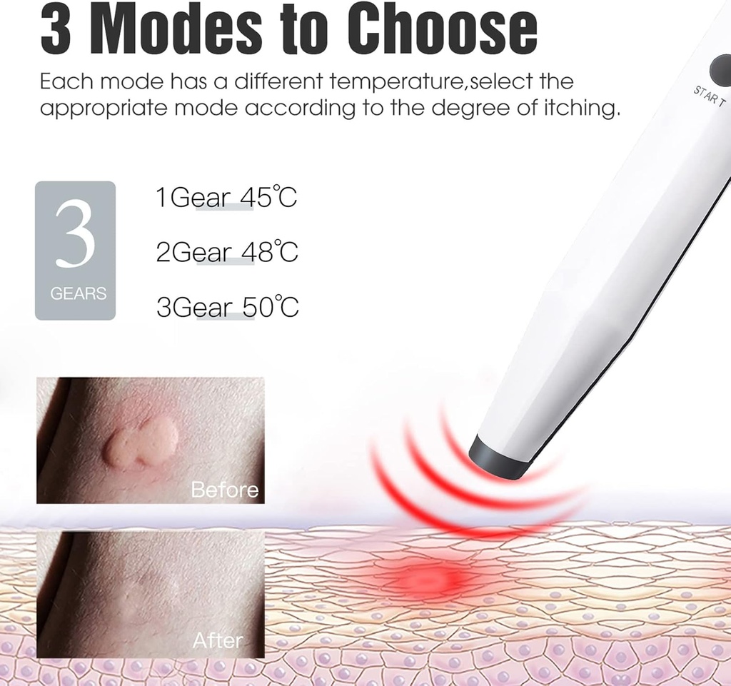 insect-sting-and-bite-relief-bug-bite-he-2.jpg