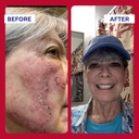 emuaid-emuaidmax-ointment-for-itchy-skin-6.jpg