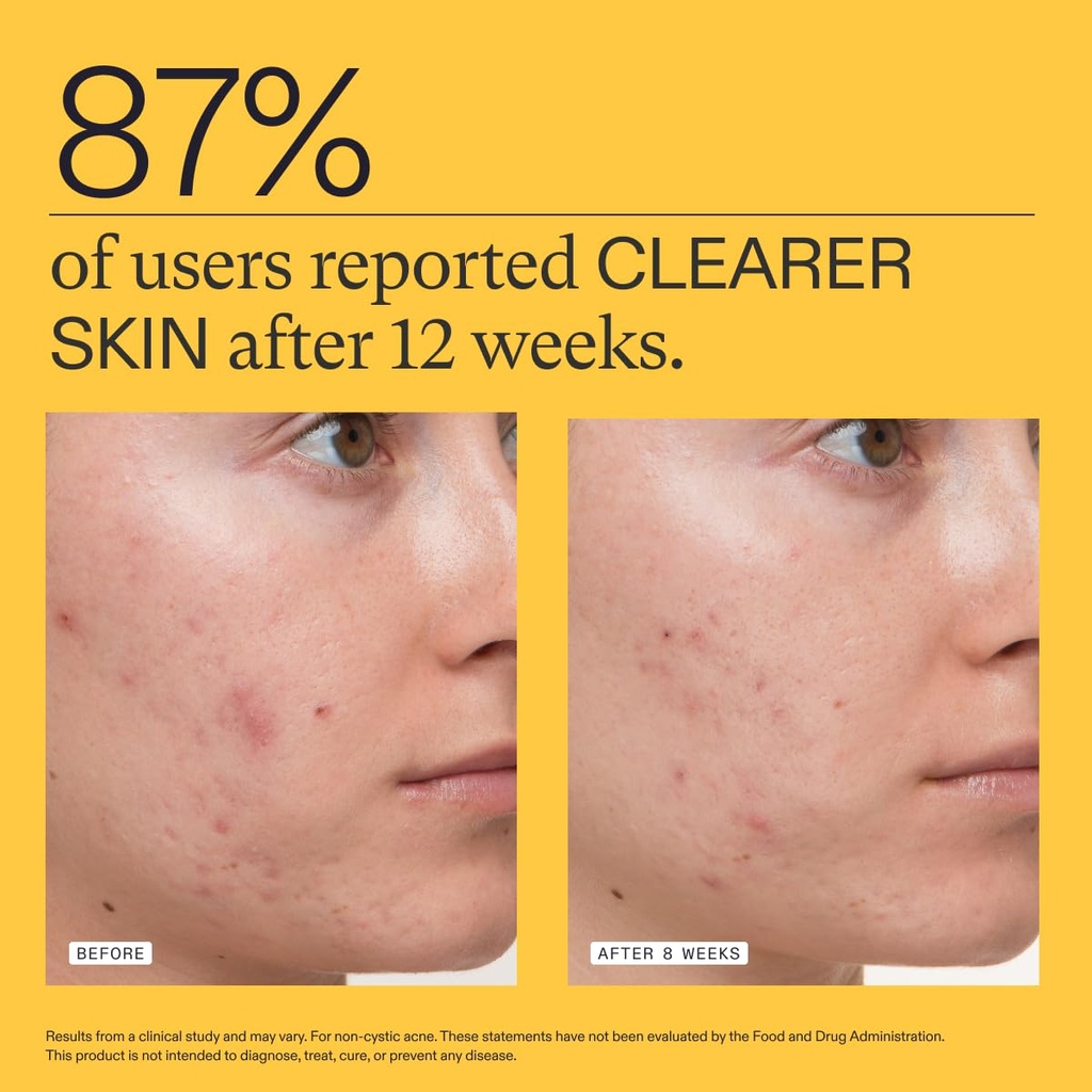 nutrafol-clear-skin-acne-supplement-for--5.jpg