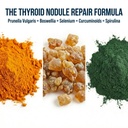 dr-westin-childs-thyroid-nodule-support--4.jpg