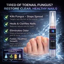 nail-fungus-treatment-pen-for-toenails-f-4.jpg
