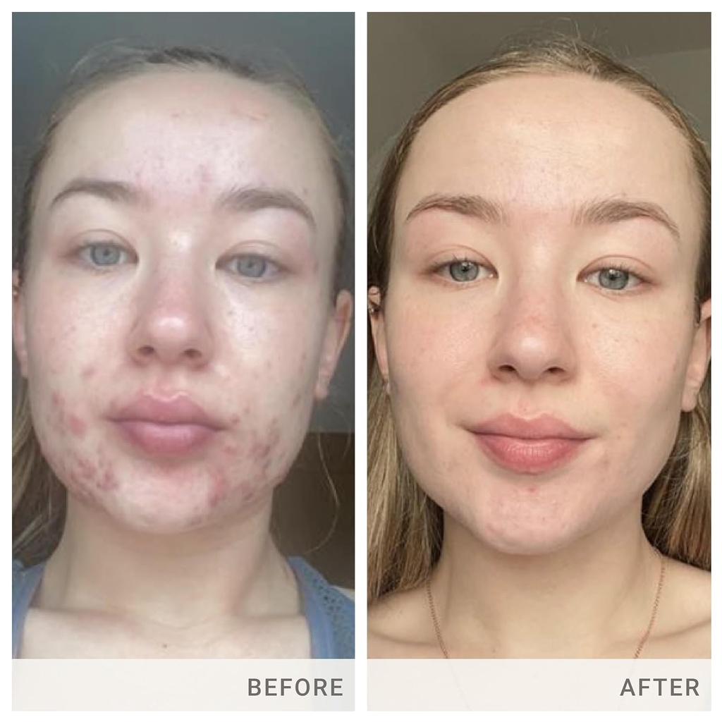 jane-iredale-skin-accumax-nutritional-su-4.jpg