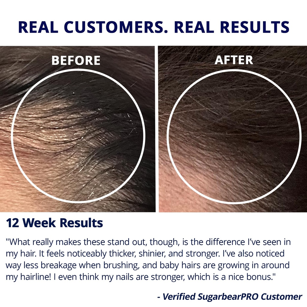 sugarbearpro-hair-vitamin-gummy-1-month--6.jpg